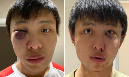 Coronavírus: Estudante de Singapura sofre ataque racista em Londres