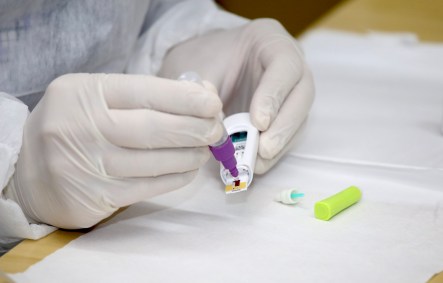 teste rápido para detecção de Covid-19