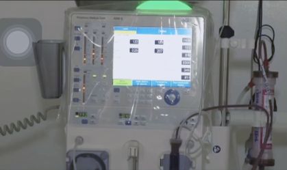 Cerca de 41% dos pacientes com Covid-19 em UTIs de SP precisam de hemodiálise