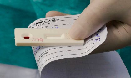 Teste rápido feito em farmácias tem resultado positivo em 15% dos casos