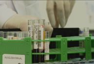 Governo do RJ refaz testes de HIV em 45 transplantados após erros em exames