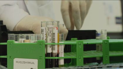 Amostras de sangue para teste sorológico da Covid-19