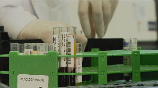 Amostras de sangue para teste sorológico da Covid-19