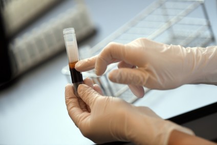 Pesquisadora analisa amostra de sangue de doador em Erlangen, na Alemanha
