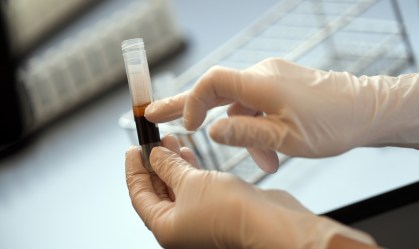 Se você pegar Covid-19, sua imunidade pode sumir em poucos meses, dizem estudos