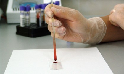 Será que certos tipos sanguíneos nos tornam mais vulneráveis à Covid-19?