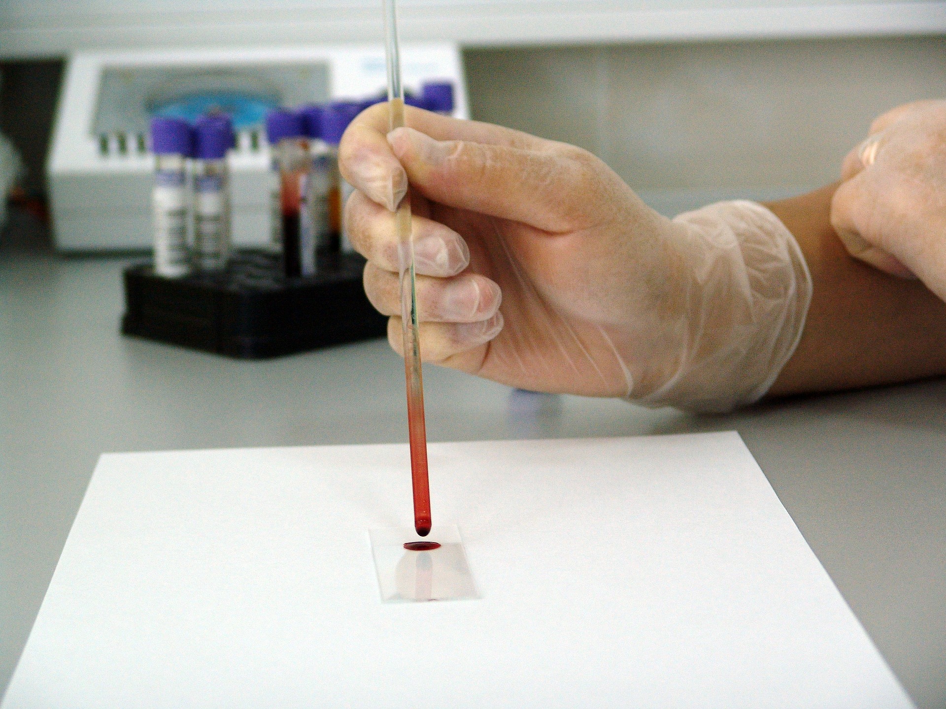 Sangue é analisado em laboratório