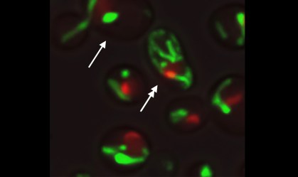 Cientistas estão a um passo de descobrir como atrasar o envelhecimento humano
