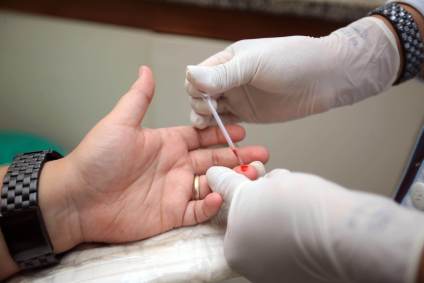 Teste para HIV