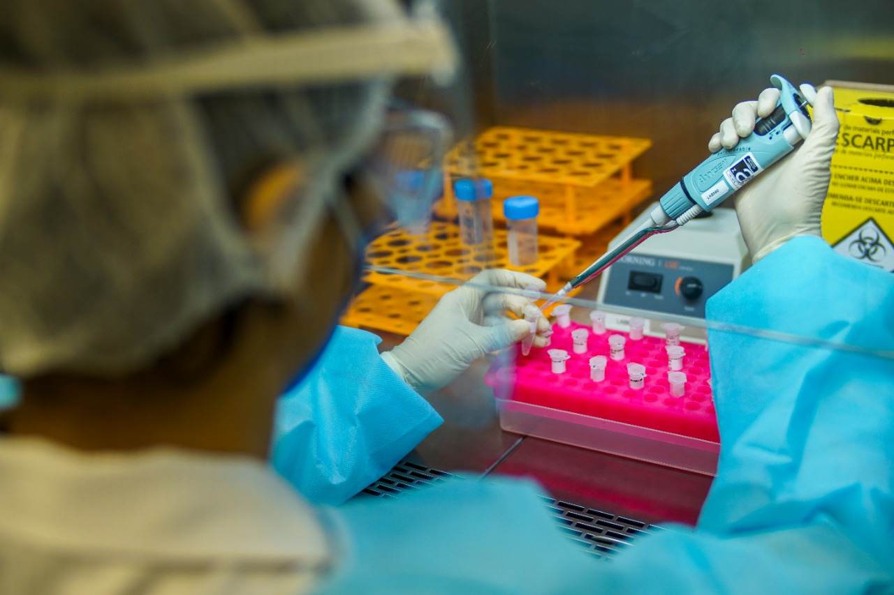 Teste de saliva detecta coronavírus Teste de saliva detecta coronavírus