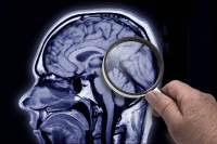 Síndrome de Tourette: veja as causas e sintomas para a doença marcada por tiques