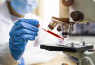 Cientistas brasileiras desenvolvem método que detecta câncer de mama pelo sangue