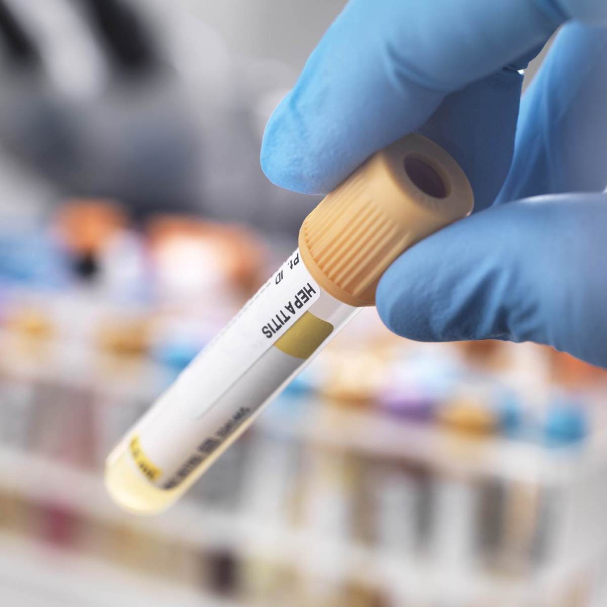 M&ecirc;s de conscientiza&ccedil;&atilde;o sobre as hepatites virais alerta para diagn&oacute;stico  precoce | CNN Brasil