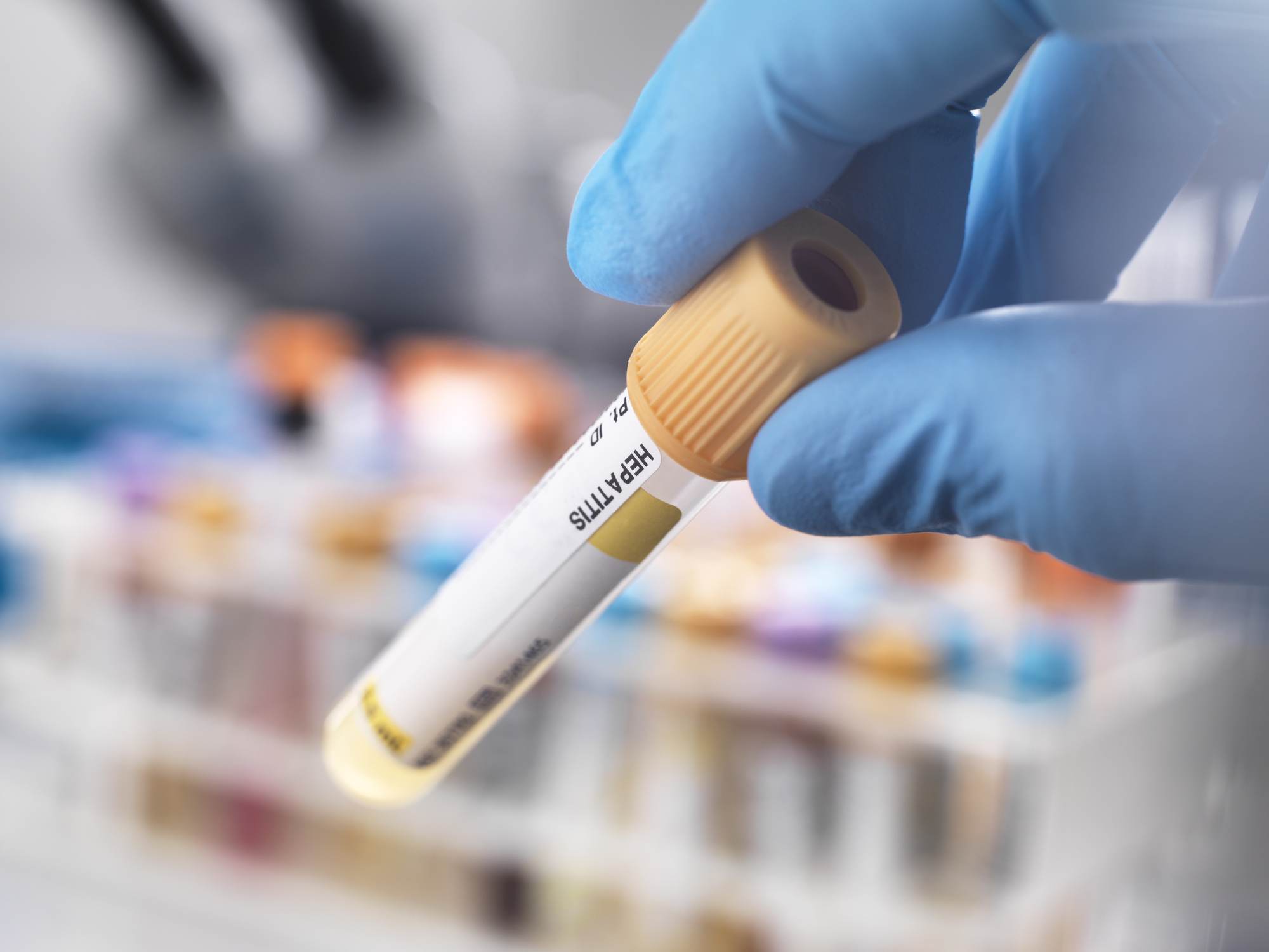 Teste de hepatite