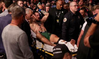 Conor McGregor diz sentir-se 'ótimo' após cirurgia na perna