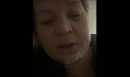 Deputada Joice Hasselman mostra ferimentos