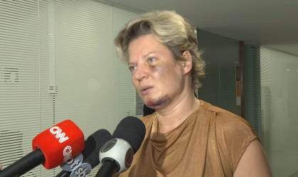 A deputada federal Joice Hasselmann (PSL-SP) conversou com a imprensa 
