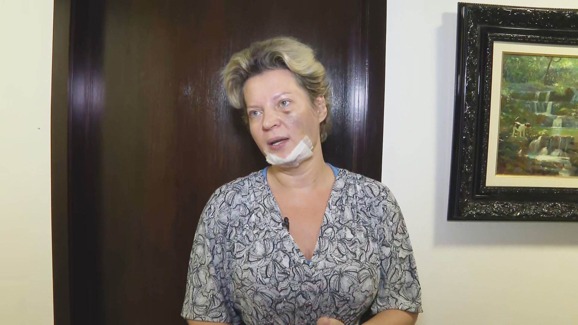 A deputada federal Joice Hasselmann (PSL-SP) mostra local das supostas agressões A deputada federal Joice Hasselmann (PSL-SP) mostra local das supostas agressões