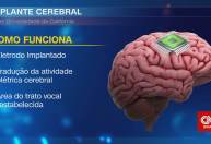 Homem que sofreu AVC usa computador para se comunicar após implante cerebral
