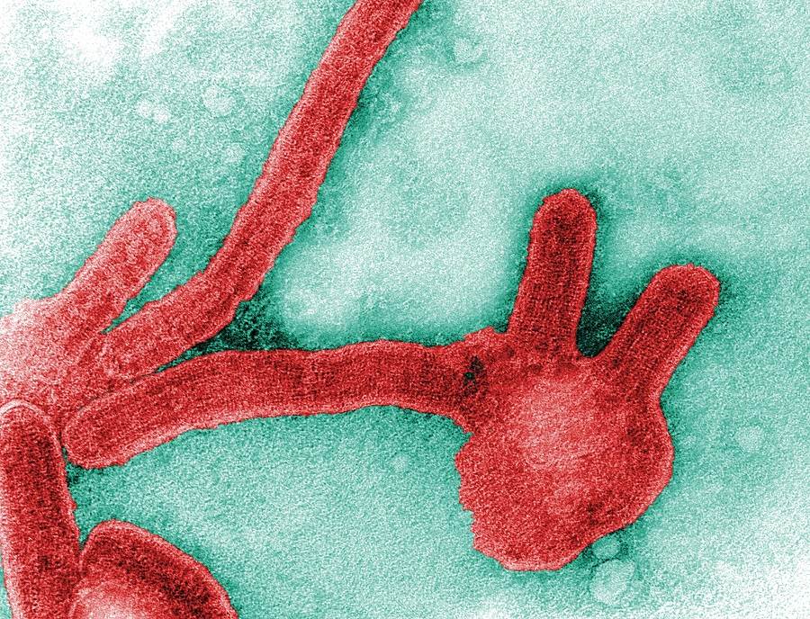 Vírus de Marburg, semelhante ao ebola, identificado em paciente morto no Guiné 