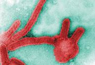 Guiné confirma primeiro caso do vírus Marburg, semelhante ao Ebola, na África