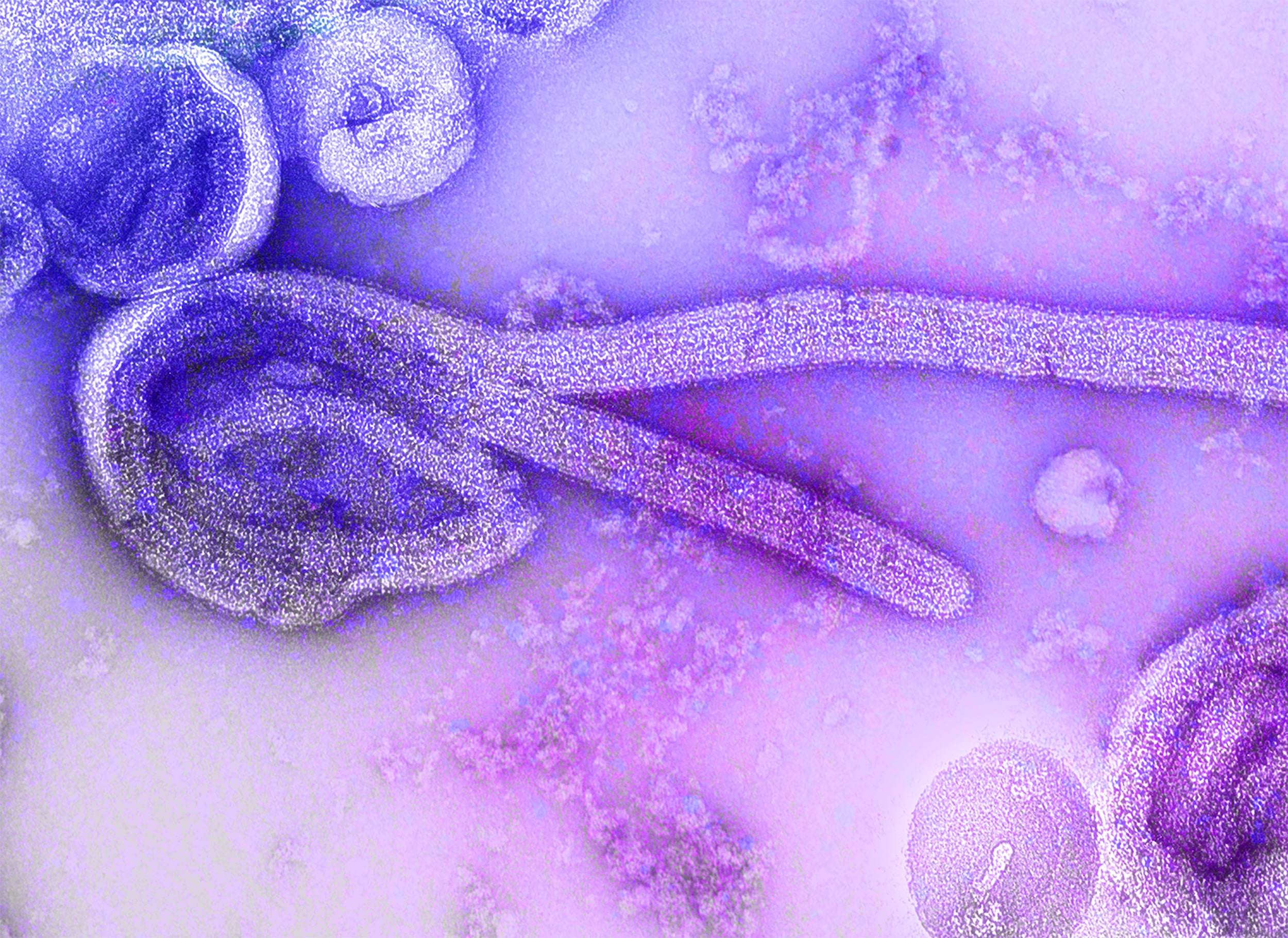Ebola, imagem microscópica