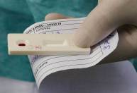 OMS fecha acordo com empresa brasileira para produzir 4 milhões de testes Covid
