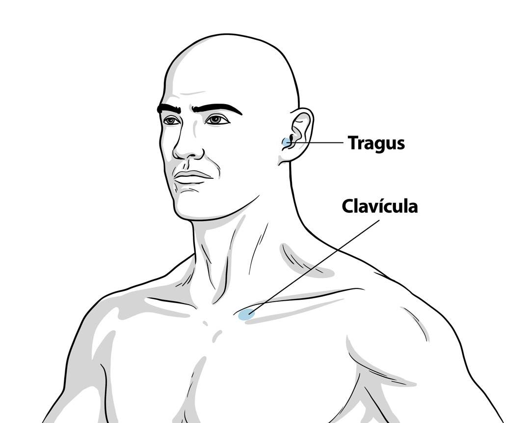 Eletrodo é colocado na região do tragus, próximo à orelha do paciente / Designer educacional EAD da Universidade Nove de Julho