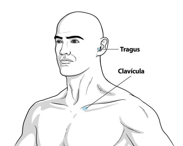 Eletrodo é colocado na região do tragus, próximo à orelha do paciente / Designer educacional EAD da Universidade Nove de Julho