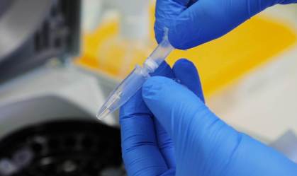Covid-19: especialistas defendem mais pesquisas sobre a origem da pandemia