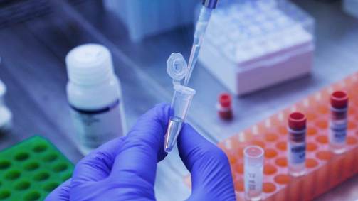 Diagnóstico do novo coronavírus