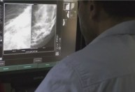 Procura por mamografia cai 45% durante a pandemia, aponta estudo