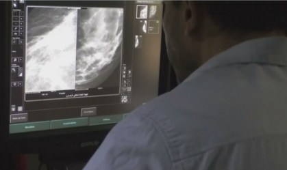 Procura por mamografia cai 45% durante a pandemia, aponta estudo