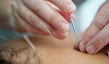 Medo de agulha? Técnicas prometem efeito semelhante à acupuntura sem perfuração