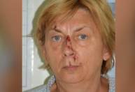 Mulher é encontrada ferida e sem memória em ilha na Croácia