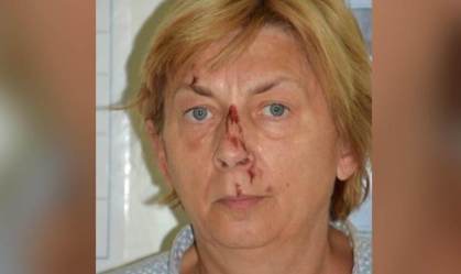Mulher é encontrada ferida e sem memória em ilha na Croácia