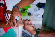 Fiocruz desenvolve novo teste que poderá otimizar o diagnóstico da hanseníase