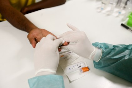 Teste rápido para diagnóstico de HIV