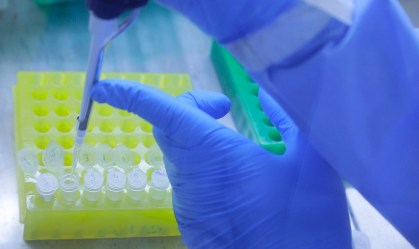 Brasil chega à média móvel de 601 mortes diárias por Covid-19
