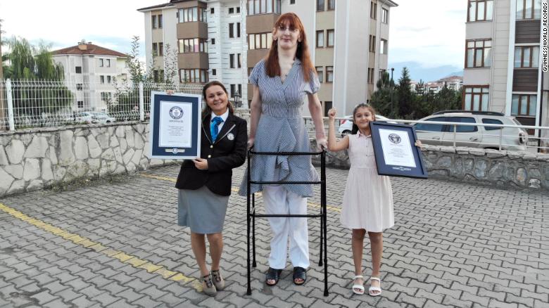 Rumeysa Gelgi, a mulher viva mais alta do mundo