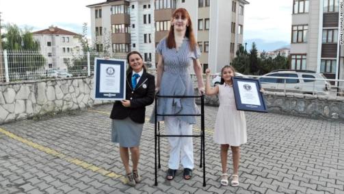 Rumeysa Gelgi, a mulher viva mais alta do mundo