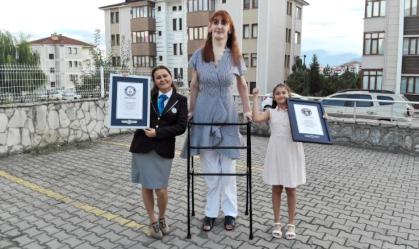 Rumeysa Gelgi, a mulher viva mais alta do mundo