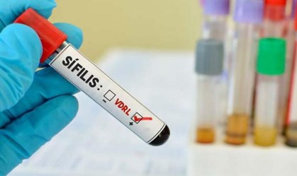 Em 11 anos, número de casos de sífilis no Brasil aumenta 16 vezes