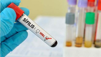 Teste Sífilis