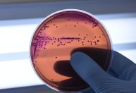 Entenda o que são superbactérias e a ameaça global da resistência a antibióticos