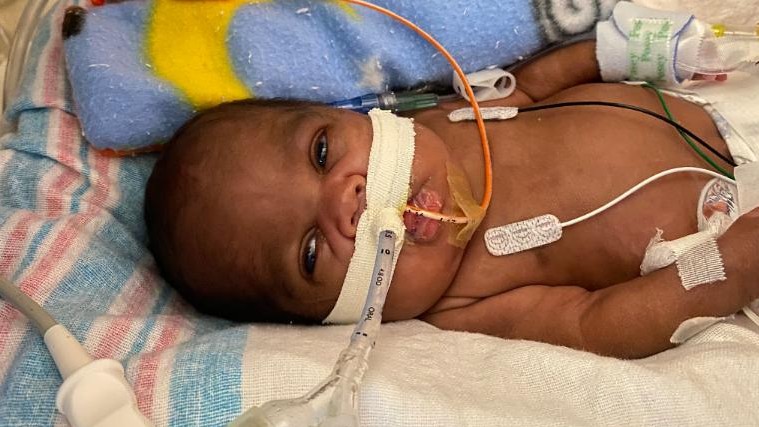 Curtis ficou sob cuidados intensivos do hospital por mais de 200 dias / Universidade de Alabama em Birmingham