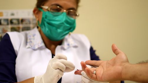 HIV | teste | exame | diagnóstico