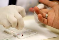 Pandemia da Covid-19 impôs desafio no combate ao avanço do HIV no mundo