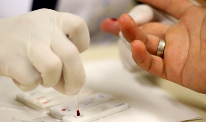 Pandemia da Covid-19 impôs desafio no combate ao avanço do HIV no mundo