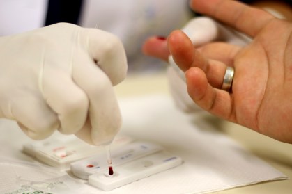 HIV | teste | exame | diagnóstico